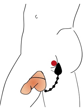 You2Toys: Intense Plug, Cock & Ball Ring